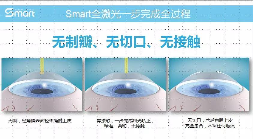 铒激光和钕激光的适用范围